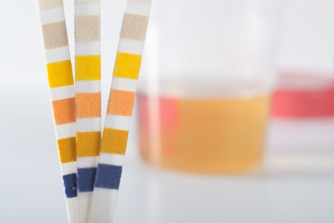 Urine Test Strip